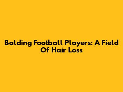 Balding Football Players: A Field Of Hair Loss