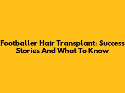 Footballer Hair Transplant: Success Stories And What To Know