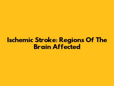 Ischemic Stroke: Regions Of The Brain Affected