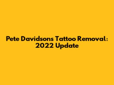Pete Davidson's Tattoo Removal: 2022 Update