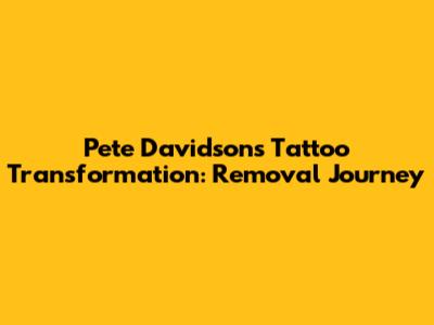 Pete Davidson's Tattoo Transformation: Removal Journey