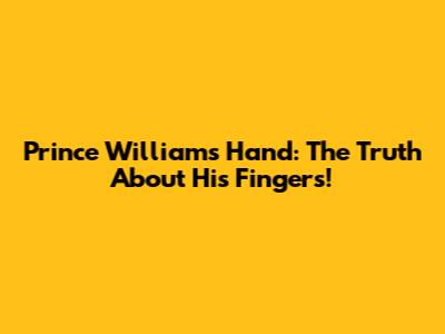 Prince William's Hand: The Truth About His Fingers!