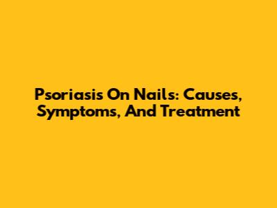 Psoriasis On Nails: Causes, Symptoms, And Treatment