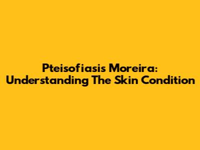 Pteisofiasis Moreira: Understanding The Skin Condition
