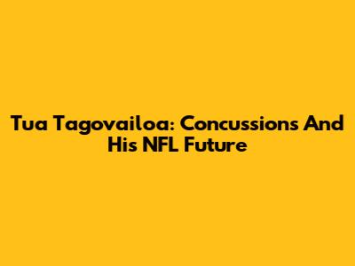 Tua Tagovailoa: Concussions And His NFL Future